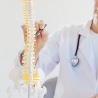 Bad Faith in Delayed Authorization for Spinal or Orthopedic Surgery