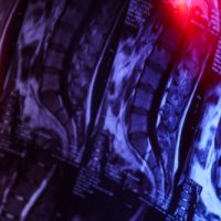 Multiple Sclerosis Coverage Delays